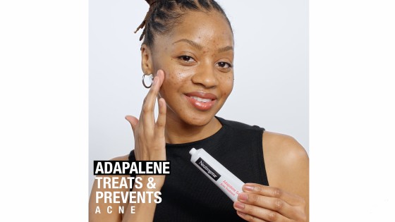 Neutrogena Adapalene Cream